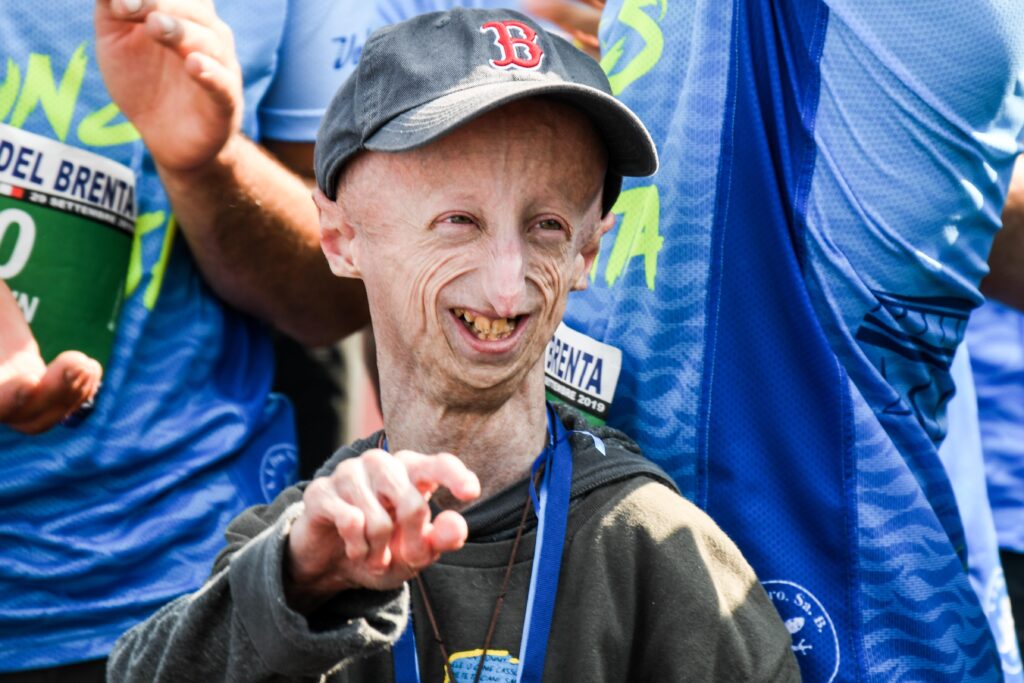 Il testamento spirituale di Sammy Basso, affetto da progeria e scomparso il 5 ottobre all'età di 28 anni